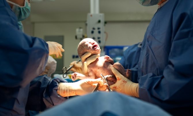 FEATURED-C-section-birth