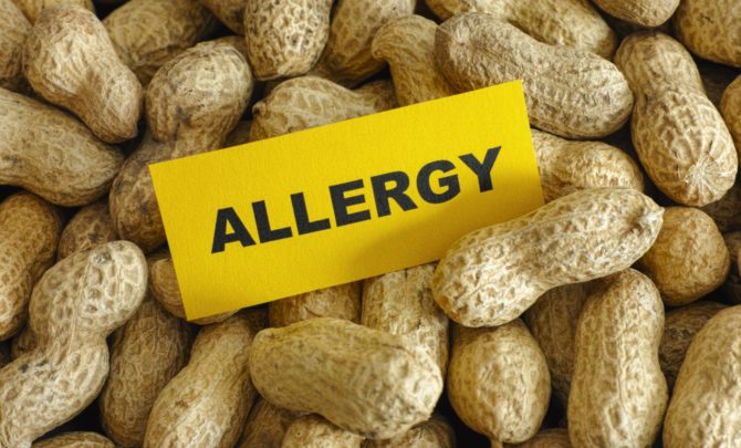 FEATURED-food-allergy